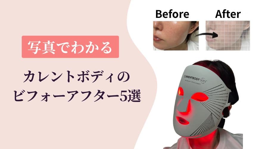 【写真で解説】カレントボディLEDマスクのビフォーアフター5選