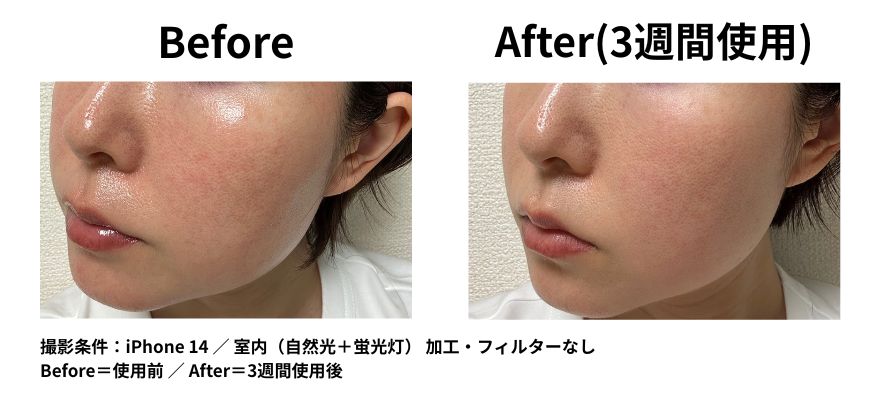 カレントボディLEDマスクのビフォーアフター|3週間使用後のリアルな口コミと効果写真