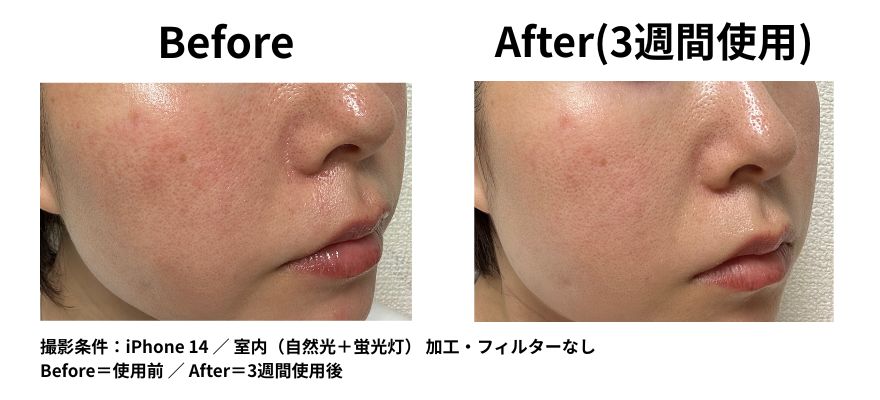 カレントボディLEDマスクのビフォーアフター|3週間使用後のリアルな口コミと効果写真