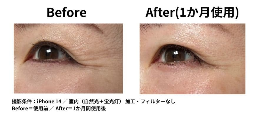 カレントボディ LEDマスクシリーズ2を使用して1ヶ月のビフォーアフター 目尻の変化