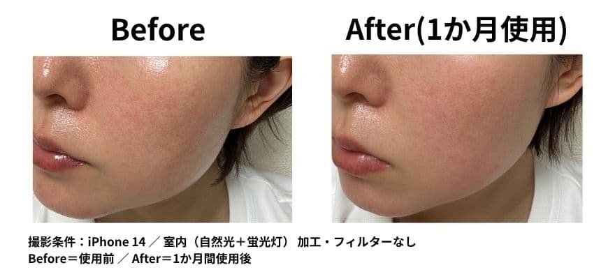 カレントボディ LEDマスクシリーズ2を使用して1ヶ月のビフォーアフター 目尻の変化 ハリの変化