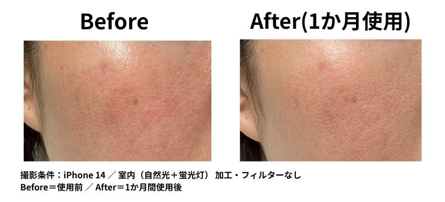 カレントボディ LEDマスクシリーズ2を使用して1ヶ月のビフォーアフター 目尻の変化 くすみの変化