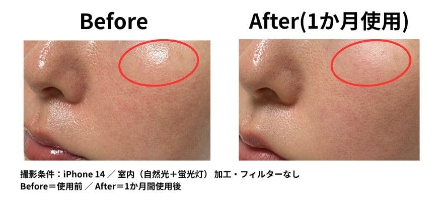 カレントボディ LEDマスクシリーズ2を使用して1ヶ月のビフォーアフター キメの変化