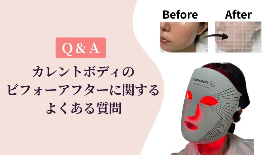 【Q&A】カレントボディLEDマスクのビフォーアフターに関するよくある質問
