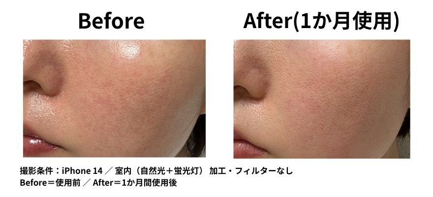カレントボディLEDマスクを使用して1ヶ月のビフォーアフター(くすみの改善)