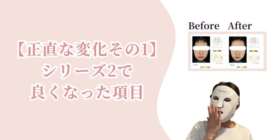 【正直な変化その1】カレントボディLEDライトセラピーマスクシリーズ2で良くなった項目