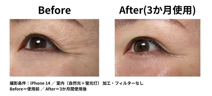 カレントボディ LEDマスクシリーズ2を使用して3ヶ月のビフォーアフター 目尻の変化