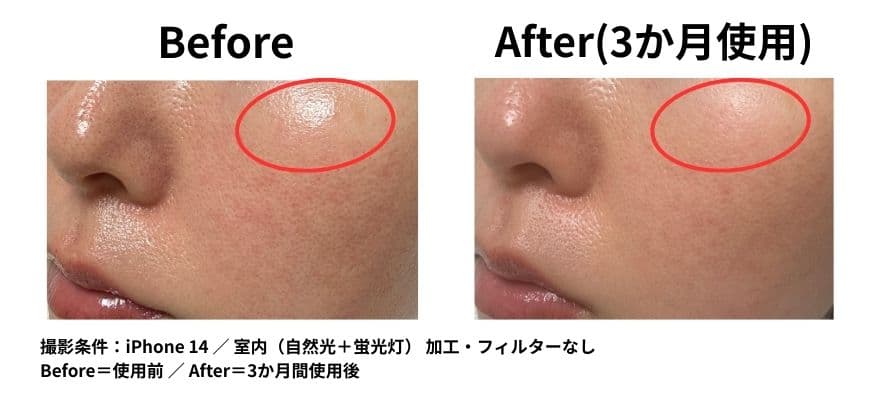 カレントボディ LEDマスクシリーズ2を使用して1ヶ月のビフォーアフター キメの変化