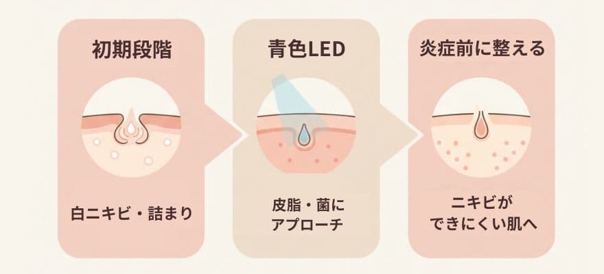カレントボディLEDマスクは白ニキビ・詰まりにおすすめ