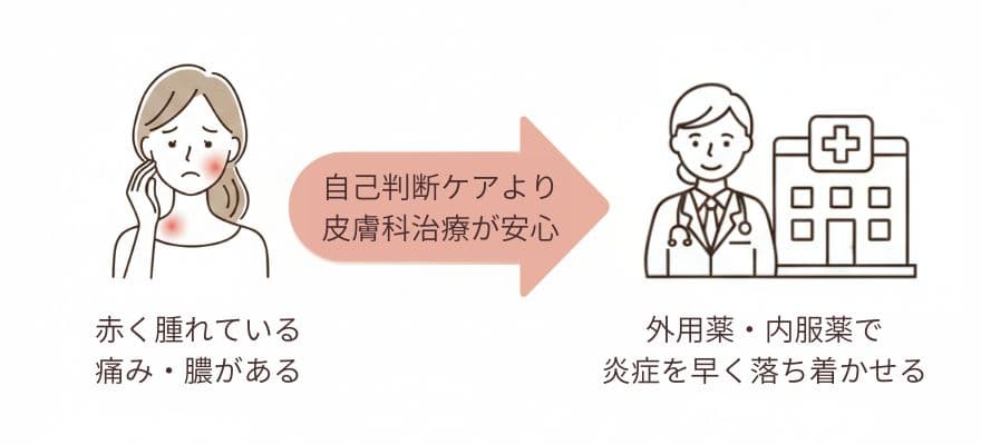 強い炎症ニキビは皮膚科が優先