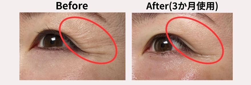 カレントボディLEDマスクの使用前と使用3か月後の目元のシワの変化