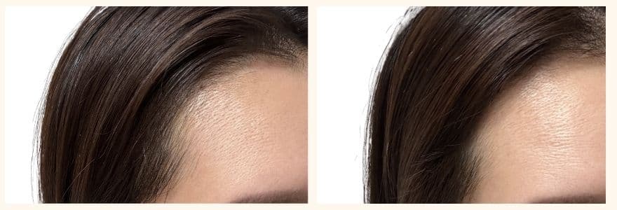 カレントボディ頭皮・頭髪ケアデバイスをの使用前と使用して1か月