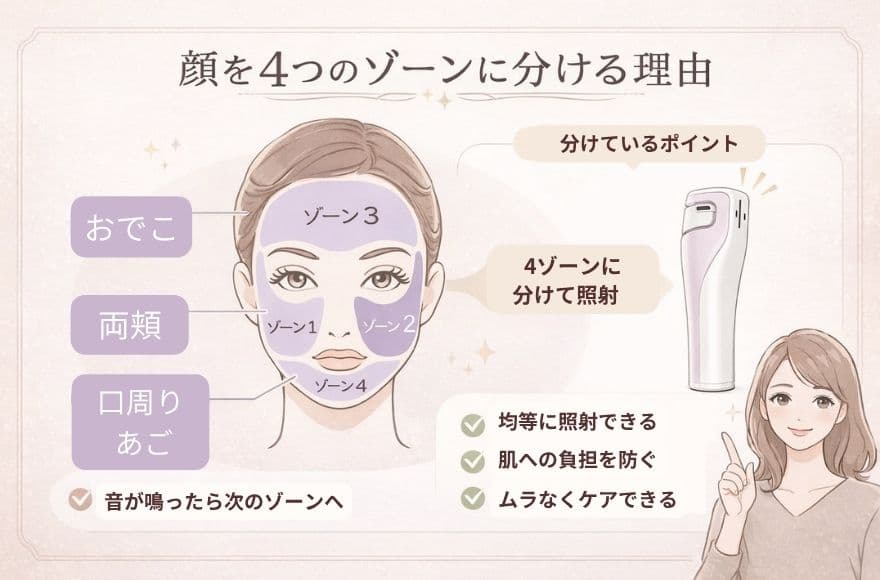 トリアレーザー美顔器の使い方、顔を4つのゾーンに分ける理由