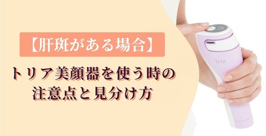 【肝斑がある場合】トリア美顔器を使う時の注意点と見分け方