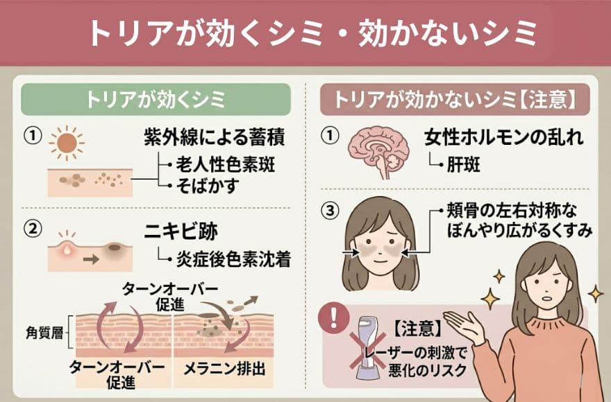 トリアが効くシミ・効かないシミ