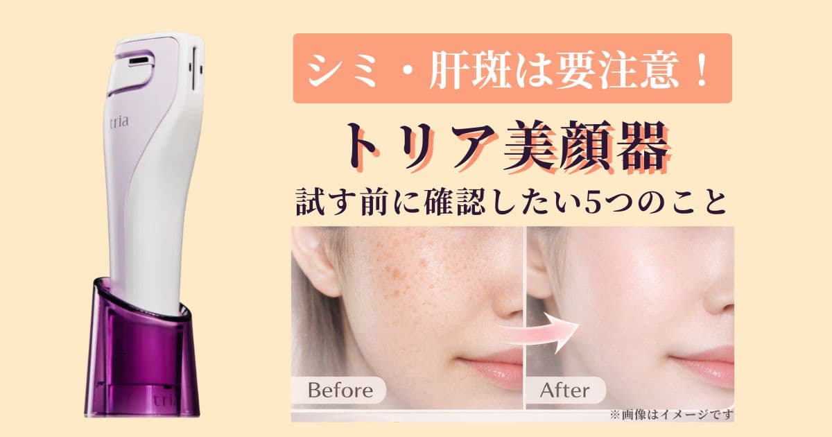 シミ・肝斑は要注意！トリア美顔器を試す前に確認したい5つのこと 