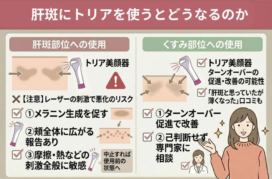 肝斑にトリアを使うとどうなるのか