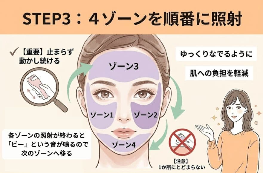トリアレーザー美顔器の使い方STEP3:4ゾーンを順番に照射