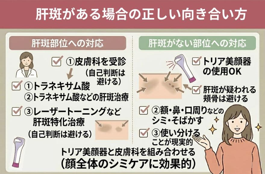 肝斑がある場合の正しい向き合い方