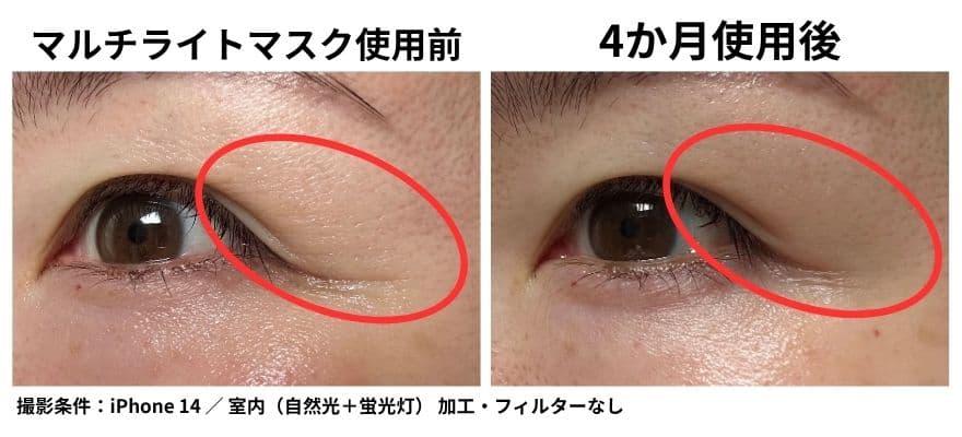 カレントボディLEDマルチライトマスクを4か月使用した目元の比較｜乾燥感と細かいシワ感の見え方