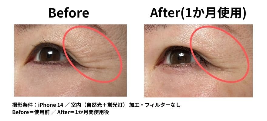 カレントボディLEDマスクを使用して1ヶ月のビフォーアフター（肌のハリ）