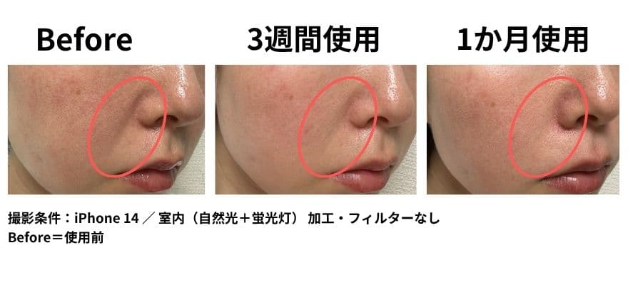 カレントボディの効果を判断するにはできれば、同じ場所・同じ照明・同じ角度で撮影しておくと、見比べやすくなります。