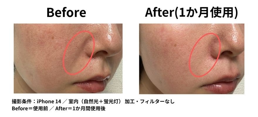 LEDマスクを使用して1ヶ月のビフォーアフター（くすみの印象）