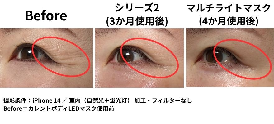 カレントボディを使う前、シリーズ2を約3か月使った後、さらにマルチライトマスクを約4か月使った後の目元の比較写真
