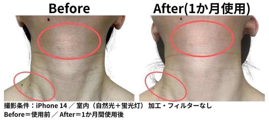 カレントボディネック＆デコルテシリーズ2を1か月使ったビフォーアフター
