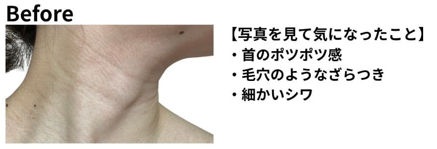 カレントボディネック＆デコルテマスクの使用前