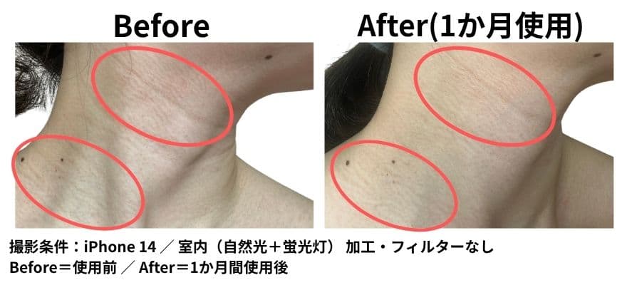 カレントボディネック＆デコルテシリーズ2を1か月使ったビフォーアフター（横から）