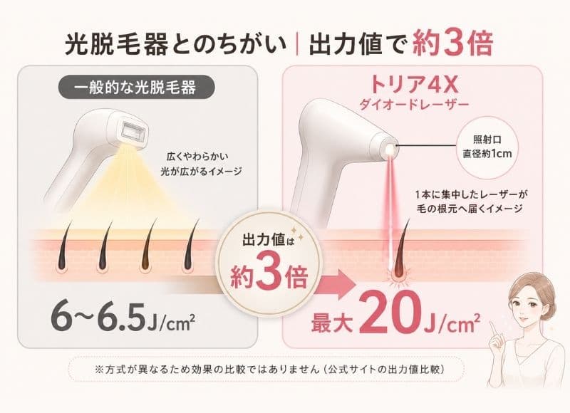 トリアのダイオードレーザー脱毛と光脱毛の違い