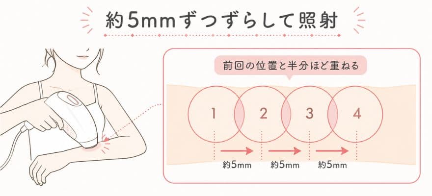 トリア脱毛器4Xの照射ポイントは少しずつずらして繰り返す