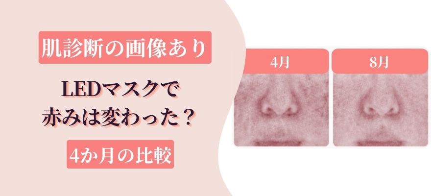 LEDマスクで赤みは変わった？肌診断画像で4か月比較