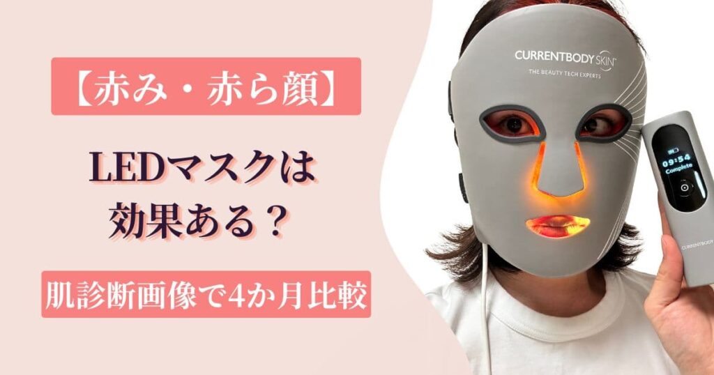 LEDマスクで赤み・赤ら顔は変わった？美容皮膚科の肌診断画像で4か月比較