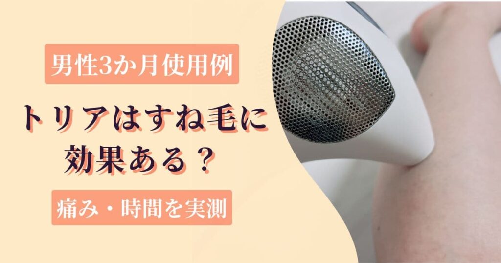 トリア4Xのすね毛脱毛は効果ある？【男性3か月使用例】痛み・時間を実測