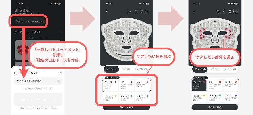 アプリで新しいトリートメントを作る手順の画面
